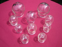 Hijaamah (Cupping) for the fasting person